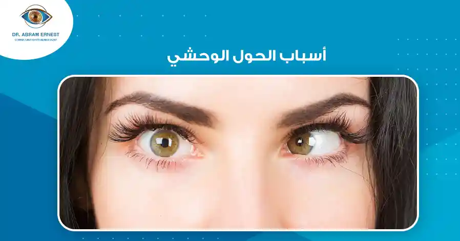 أسباب الإصابة بالحول الوحشي