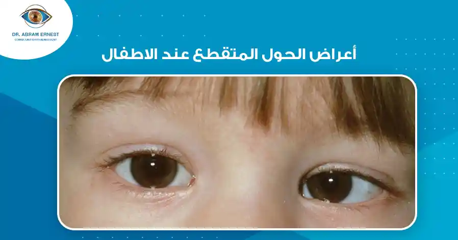 أعراض الحول الوحشي المتقطع عند الاطفال