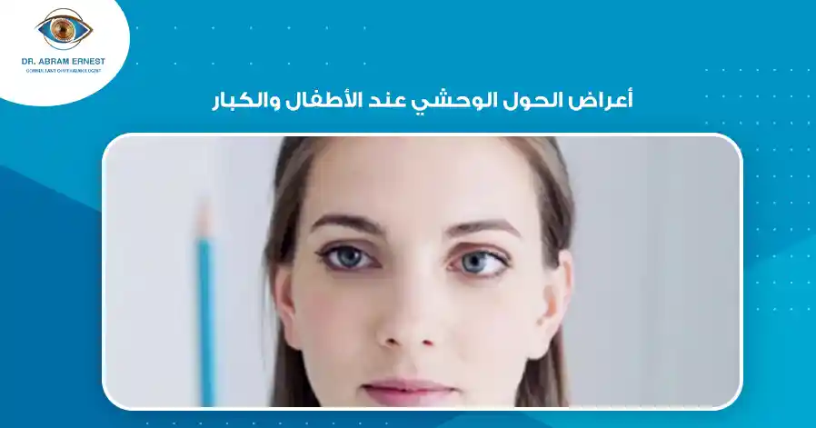 أعراض الحول الوحشي عند الأطفال والكبار