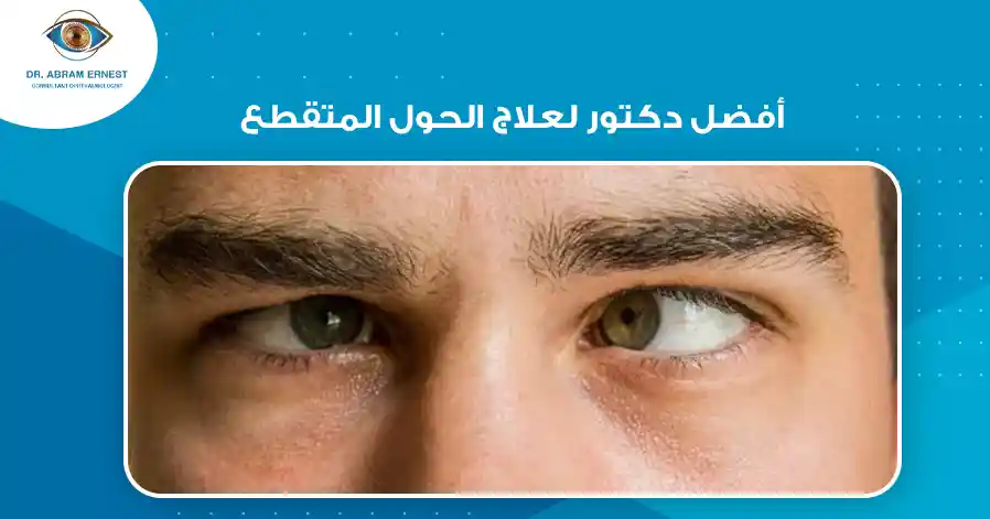 أفضل دكتور لعلاج الحول المتقطع