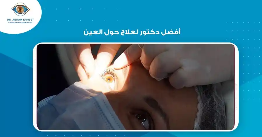 أفضل دكتور لعلاج حول العين المفاجئ