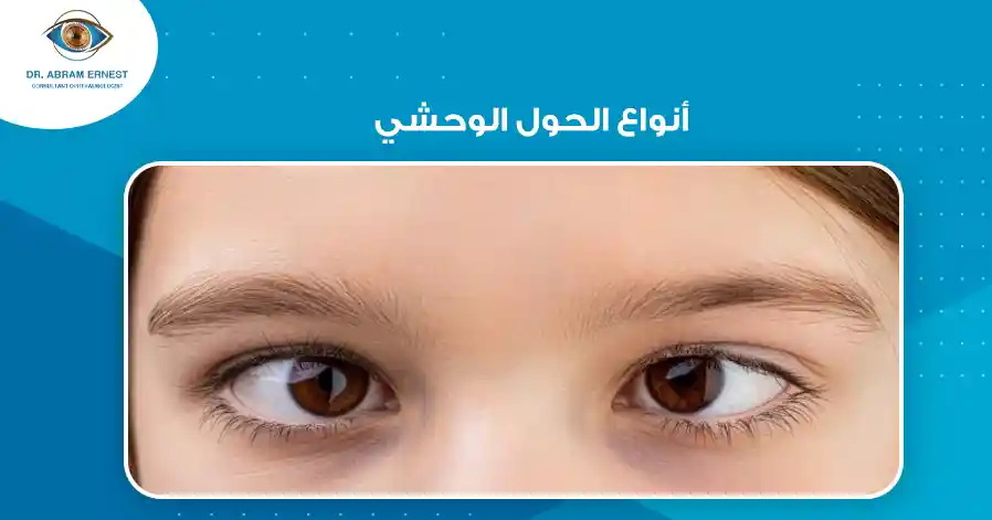 أنواع الحول الوحشي