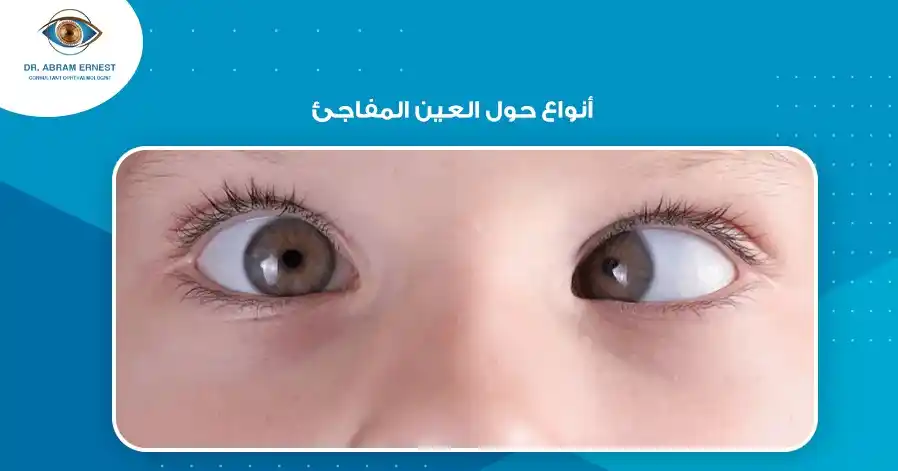 أنواع حول العين المفاجئ