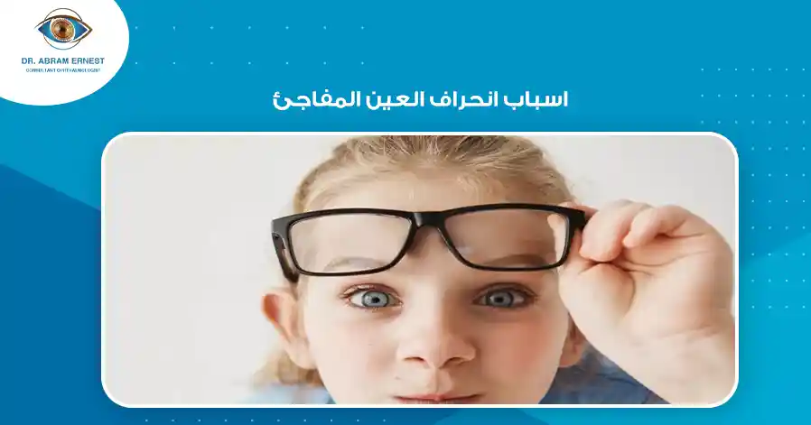 اسباب انحراف العين المفاجئ