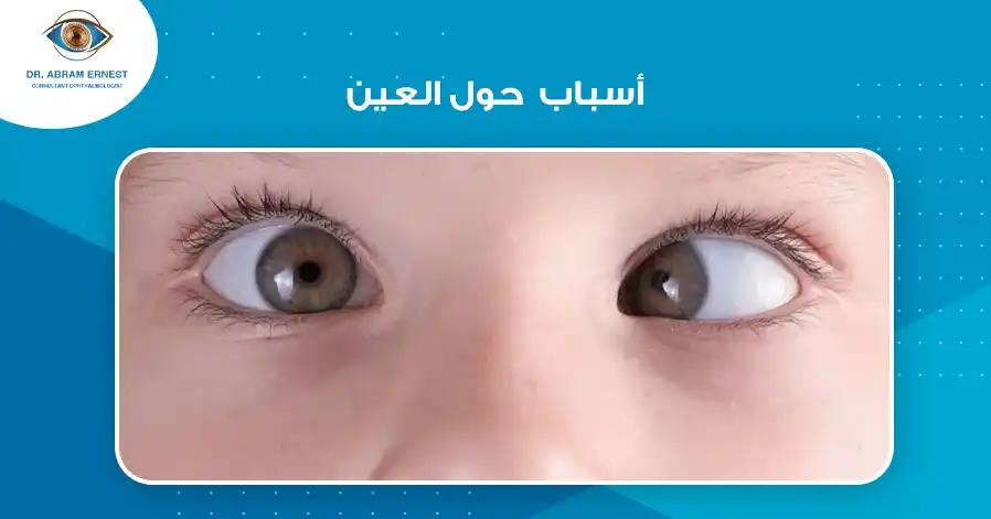 اسباب حول العين