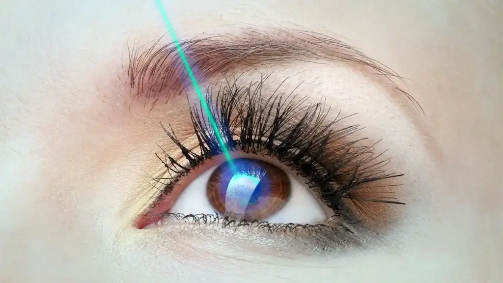 تصحيح-عيوب-الأبصار-بالفيمتوليزر