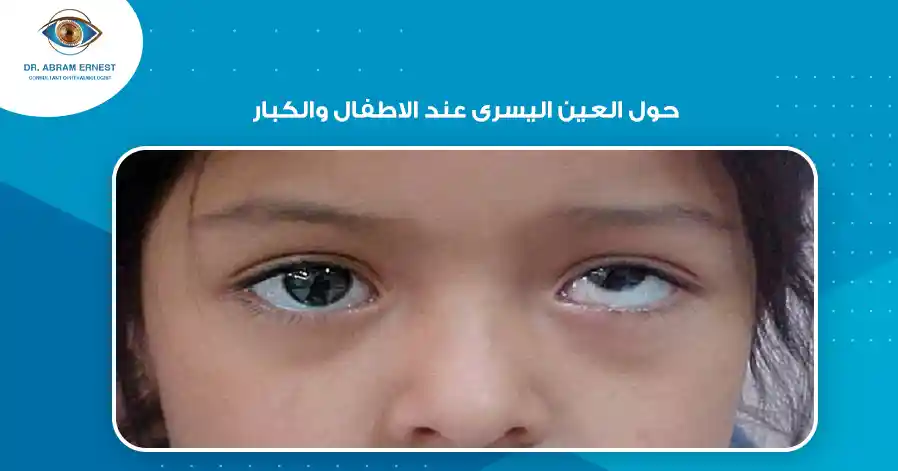 ما هو حول العين اليسرى عند الاطفال والكبار