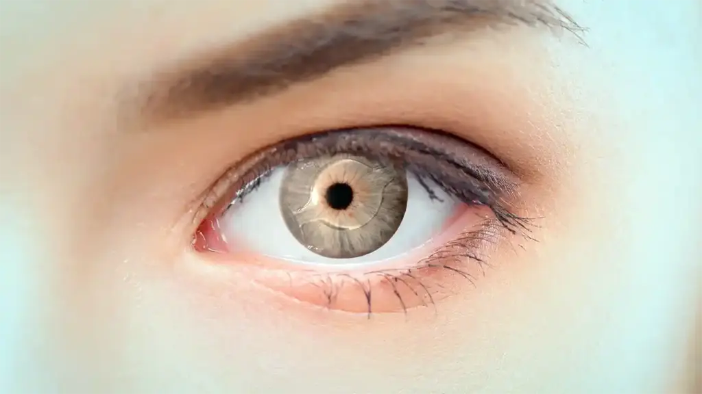 زراعة العدسات