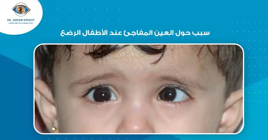سبب حول العين المفاجئ عند الأطفال الرضع