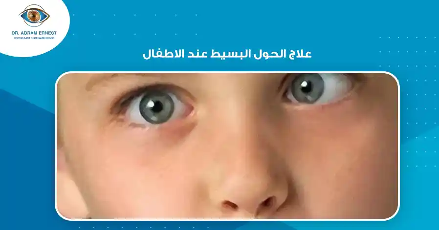 علاج الحول البسيط عند الاطفال