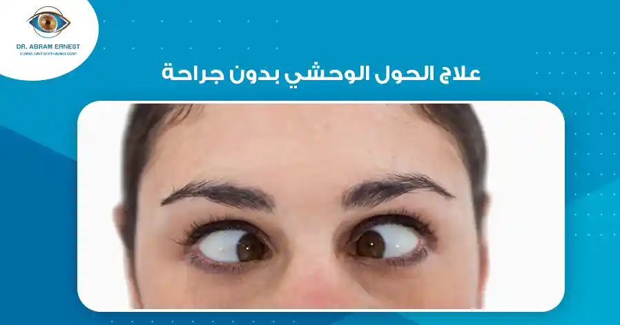 علاج الحول الوحشي بدون جراحة