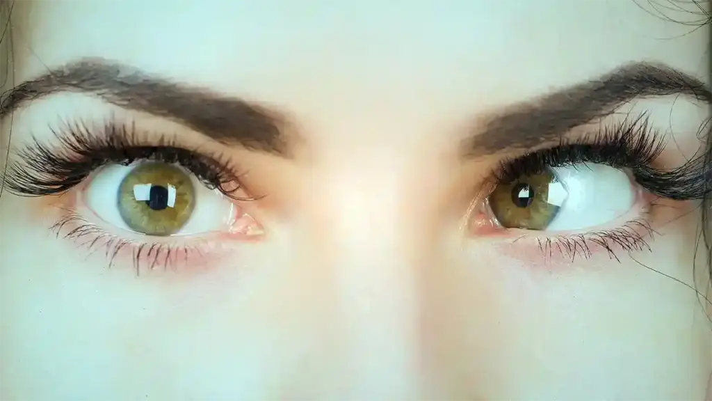 عمليات-الحول-عند-الأطفال-والكبار