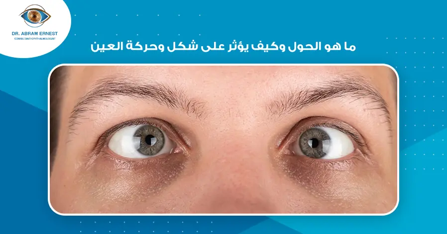 ما-هو-الحول