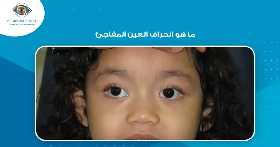 ما هو انحراف العين المفاجئ