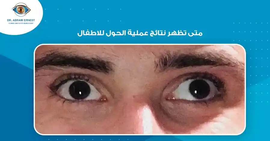 متى تظهر نتائج عملية الحول للاطفال