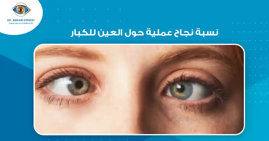 نسبة نجاح عملية حول العين للكبار