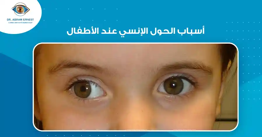 أسباب الحول الإنسي عند الأطفال