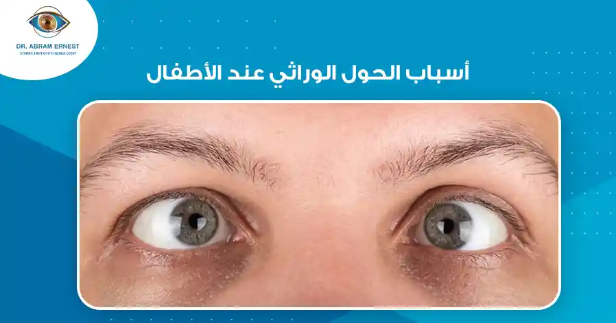 أسباب الحول الوراثي عند الأطفال