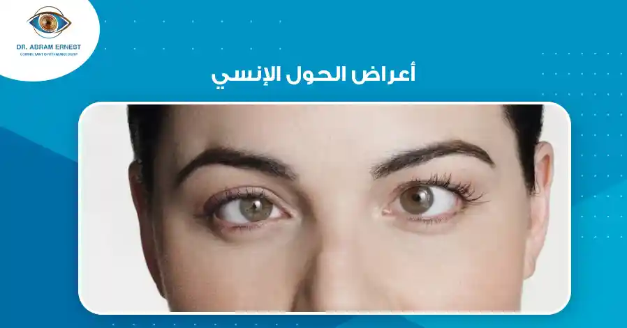 أعراض الحول الإنسي