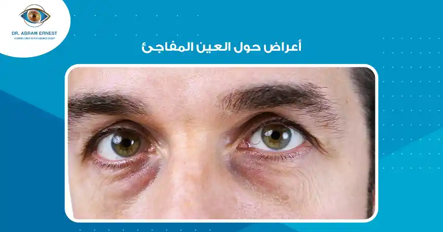 أعراض حول العين المفاجئ
