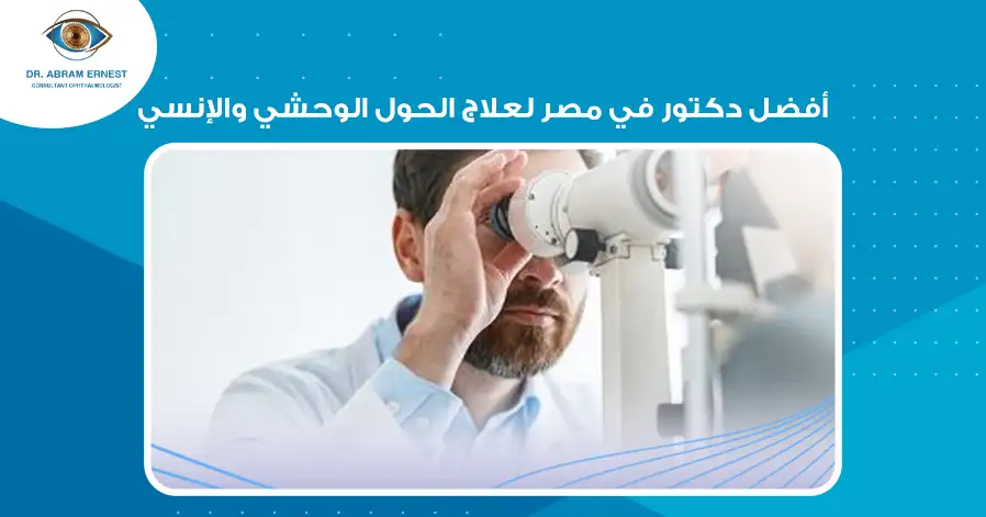 أفضل دكتور في مصر لعلاج الحول الوحشي والإنسي
