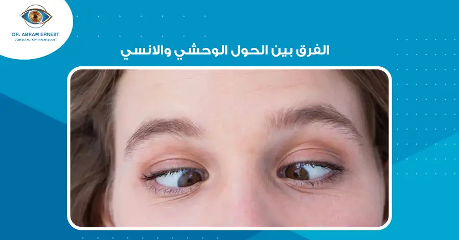 الفرق بين الحول الوحشي والانسي