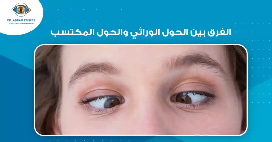 الفرق بين الحول الوراثي والحول المكتسب