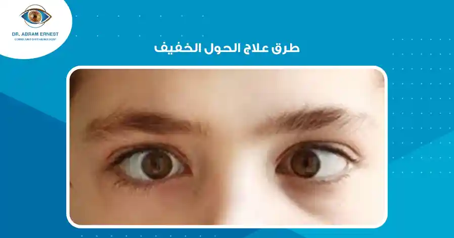 طرق علاج الحول الخفيف