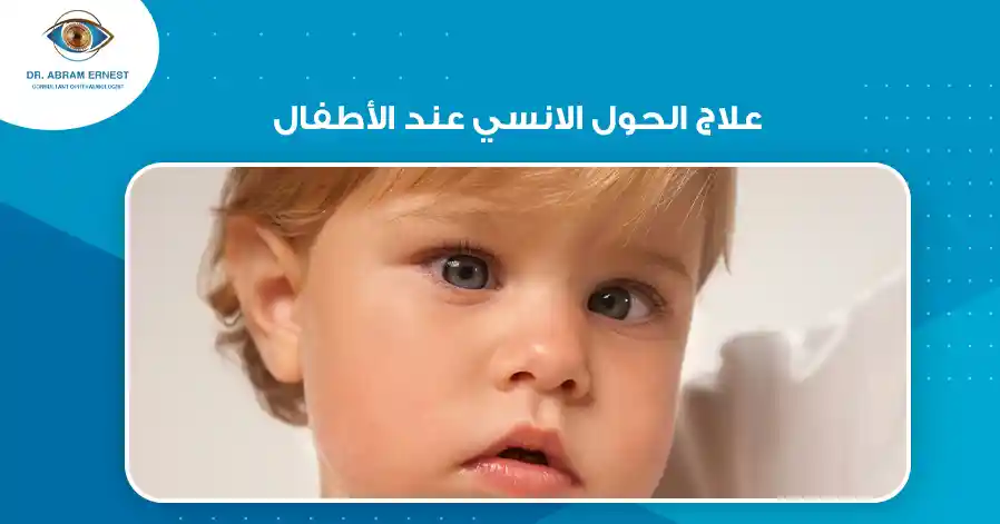 علاج الحول الانسي عند الأطفال