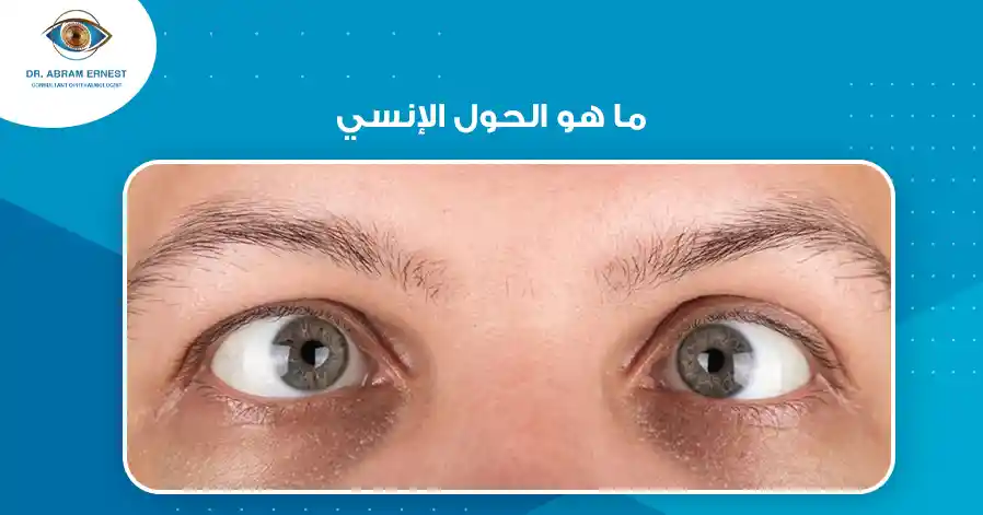 ما هو الحول الإنسي