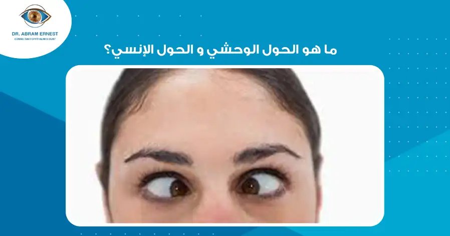 ما هو الحول الوحشي و الحول الإنسي؟
