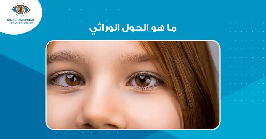 ما هو الحول الوراثي