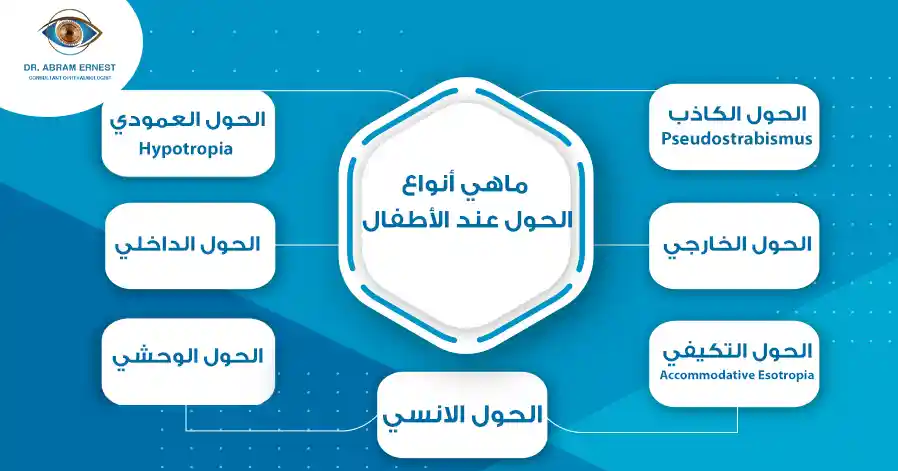ماهي أنواع الحول عند الأطفال