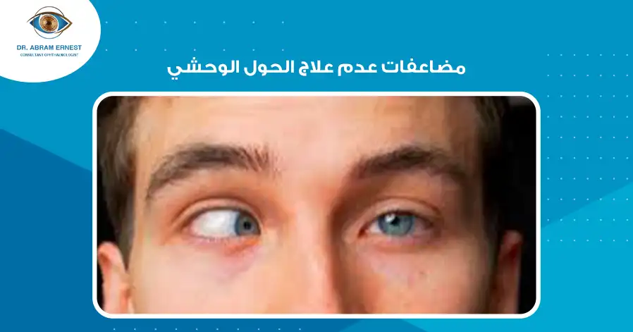 مضاعفات عدم علاج الحول الوحشي