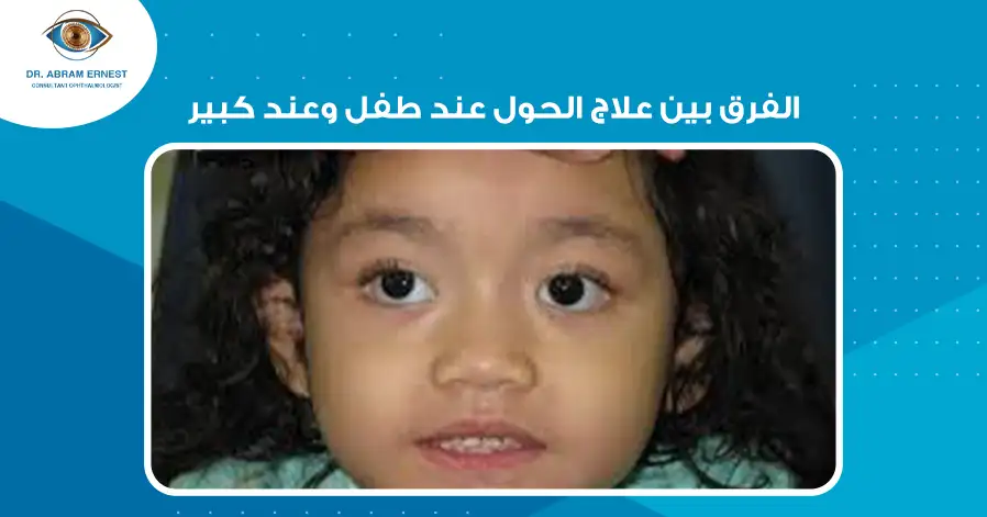 الفرق بين علاج الحول عند طفل وعند كبير
