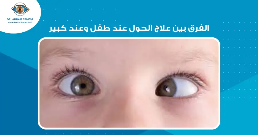 الفرق بين علاج الحول عند طفل وعند كبير
