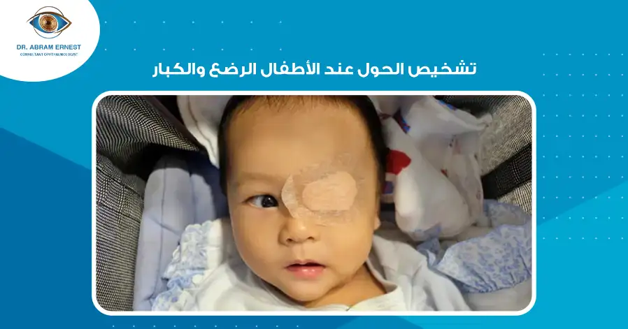 تشخيص الحول عند الأطفال الرضع والكبار
