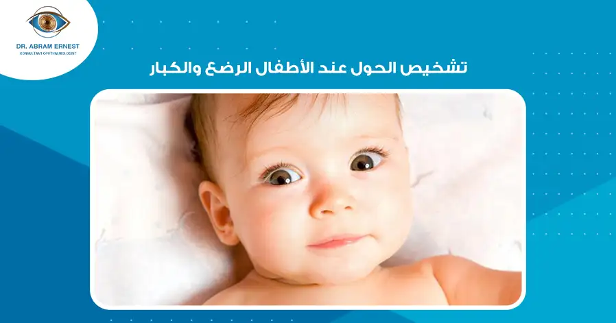 تشخيص الحول عند الأطفال الرضع والكبار
