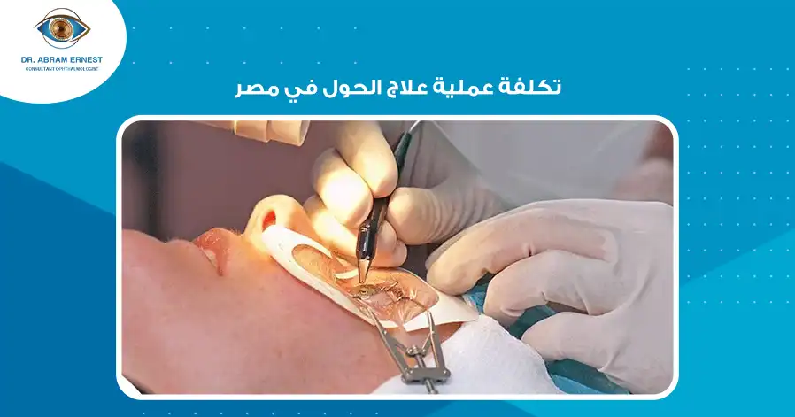 تكلفة عملية علاج الحول في مصر