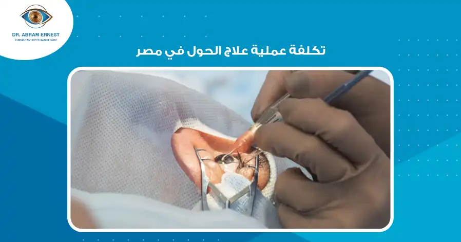 تكلفة عملية علاج الحول في مصر