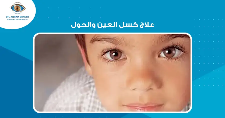 علاج كسل العين والحول