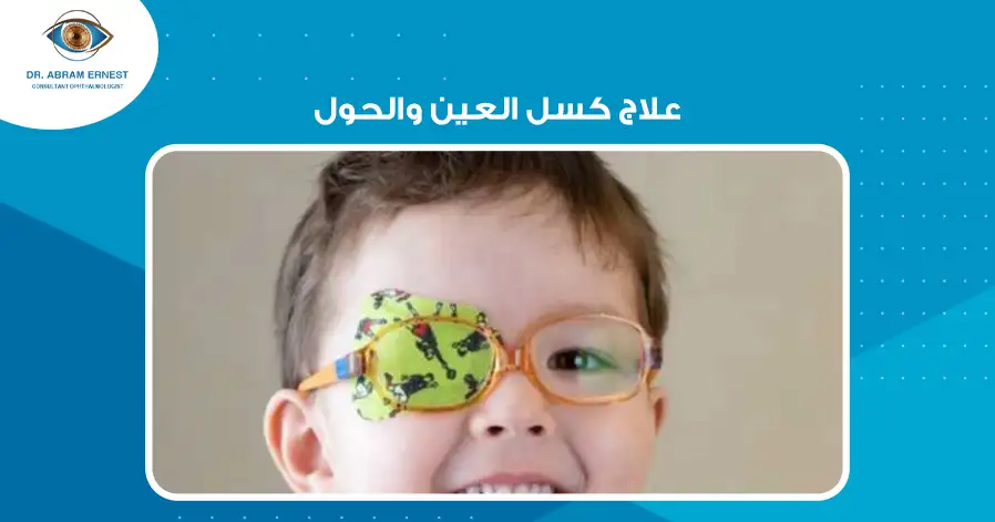 علاج كسل العين والحول