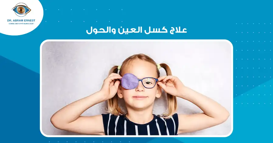 علاج كسل العين والحول