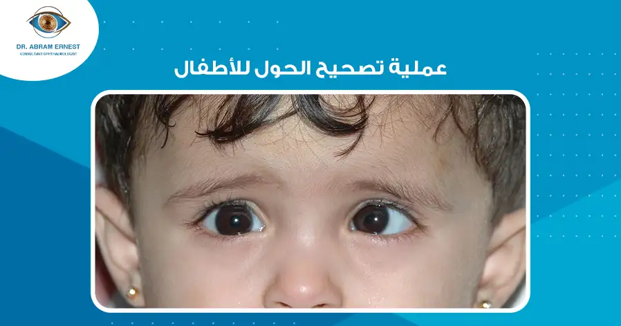 عملية تصحيح الحول للأطفال