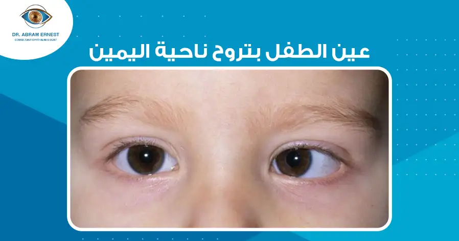 عين الطفل بتروح ناحية اليمين
