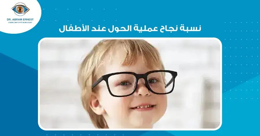 نسبة نجاح عملية الحول عند الأطفال