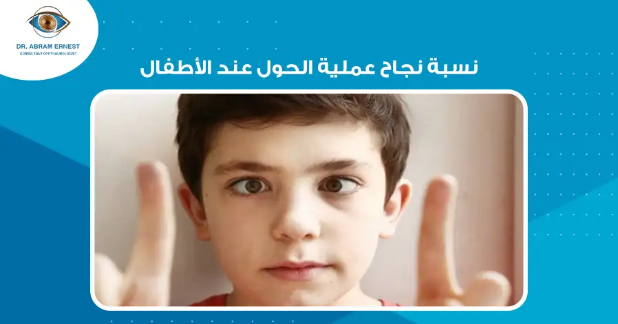 نسبة نجاح عملية الحول عند الأطفال