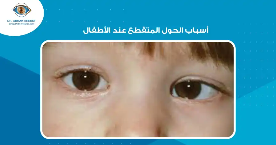 أسباب الحول المتقطع عند الأطفال