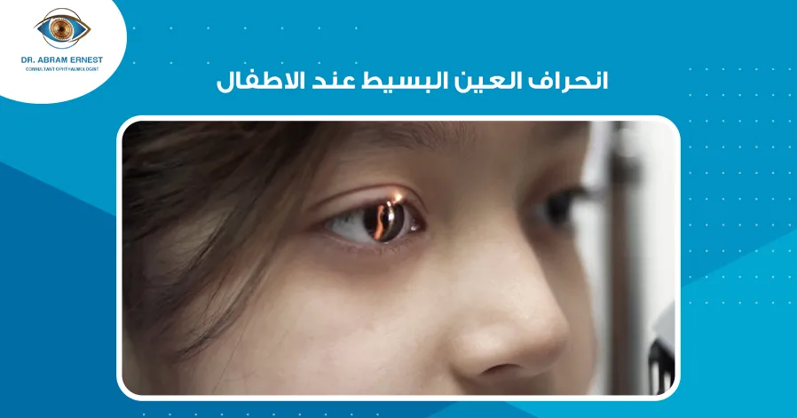 انحراف العين البسيط عند الاطفال