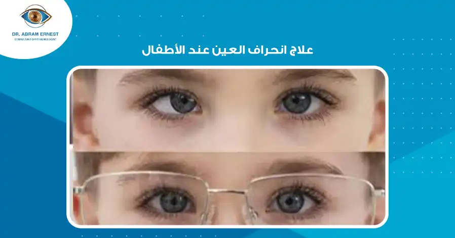 علاج انحراف العين عند الأطفال